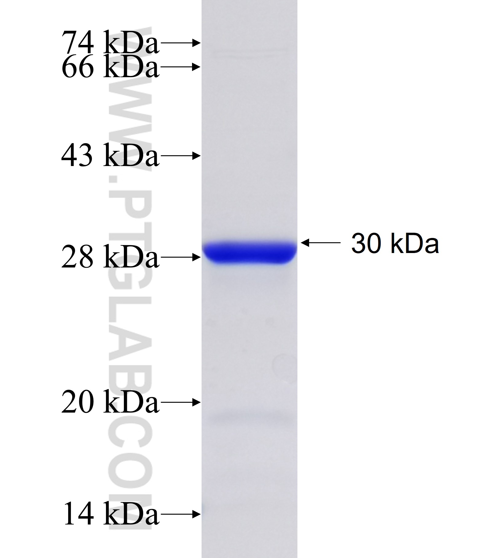 RNF180 fusion protein Ag34922 SDS-PAGE RNF180 fusion protein Ag34922 SDS-PAGE