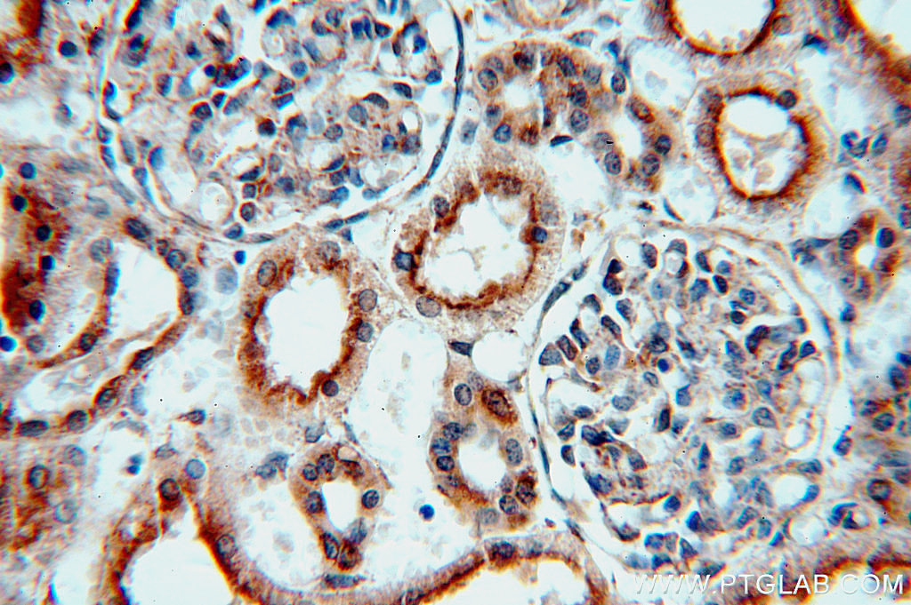 IHC staining of human kidney using 20408-1-AP