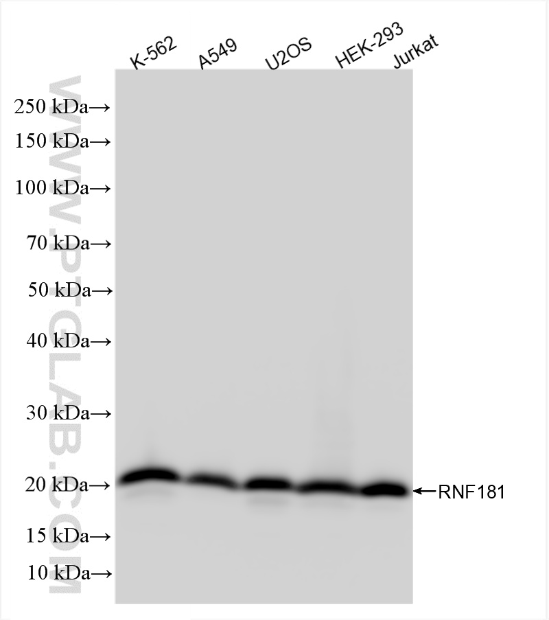 WB analysis using 85735-2-RR (same clone as 85735-2-PBS)