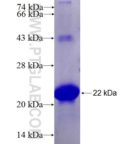 RNF182 fusion protein Ag27325 SDS-PAGE RNF182 fusion protein Ag27325 SDS-PAGE