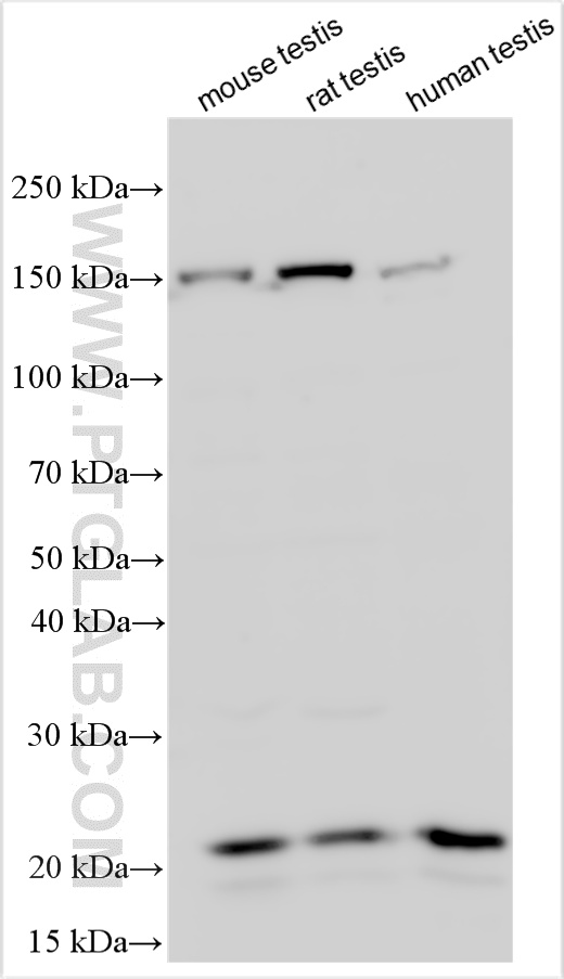 WB analysis using 32956-1-AP (same clone as 32956-1-PBS)