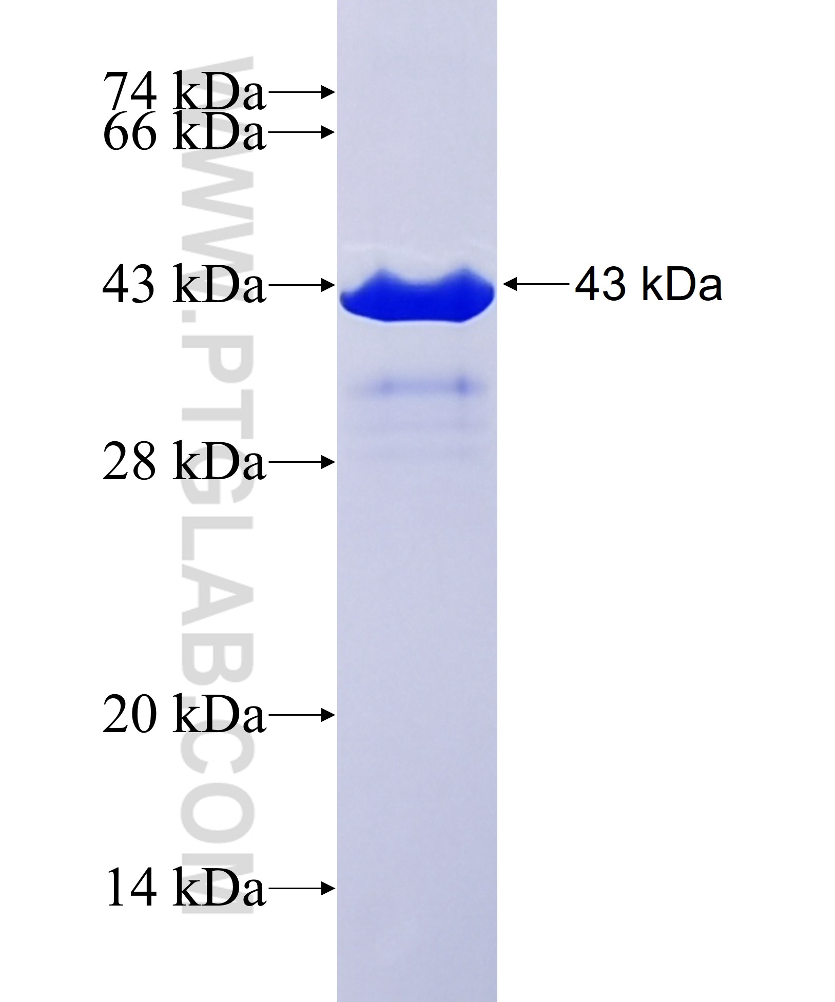 RNF185 fusion protein Ag38937 SDS-PAGE
