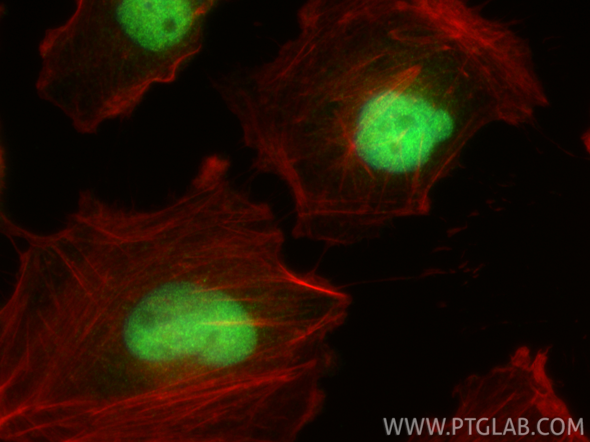 IF Staining of U-251 using 32939-1-AP IF Staining of U-251 using 32939-1-AP