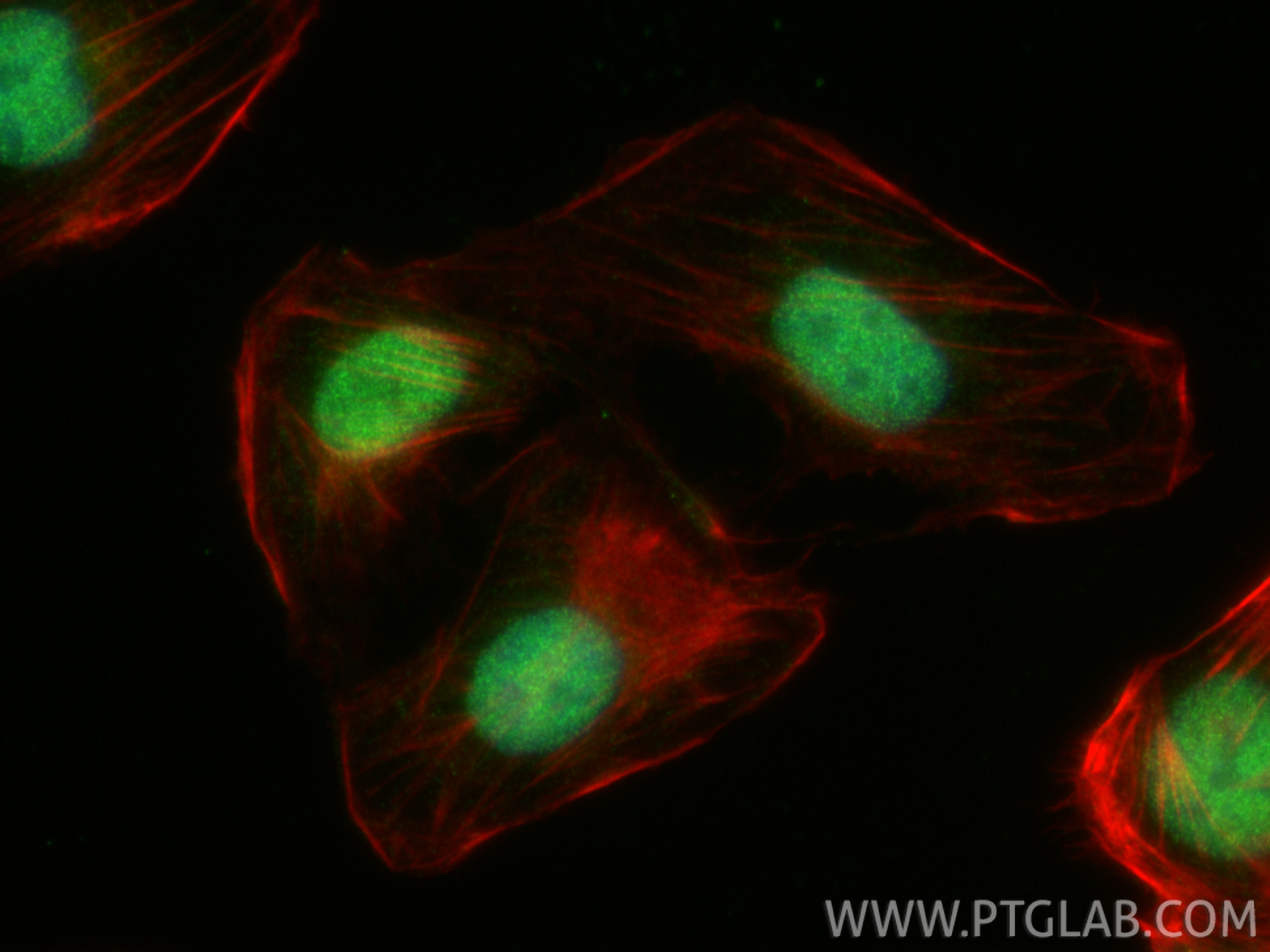 IF Staining of U2OS using 32939-1-AP (same clone as 32939-1-PBS)