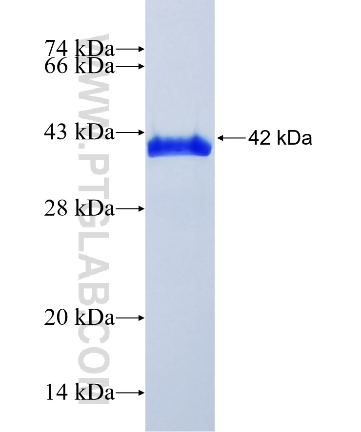 RNF187 fusion protein Ag36665 SDS-PAGE