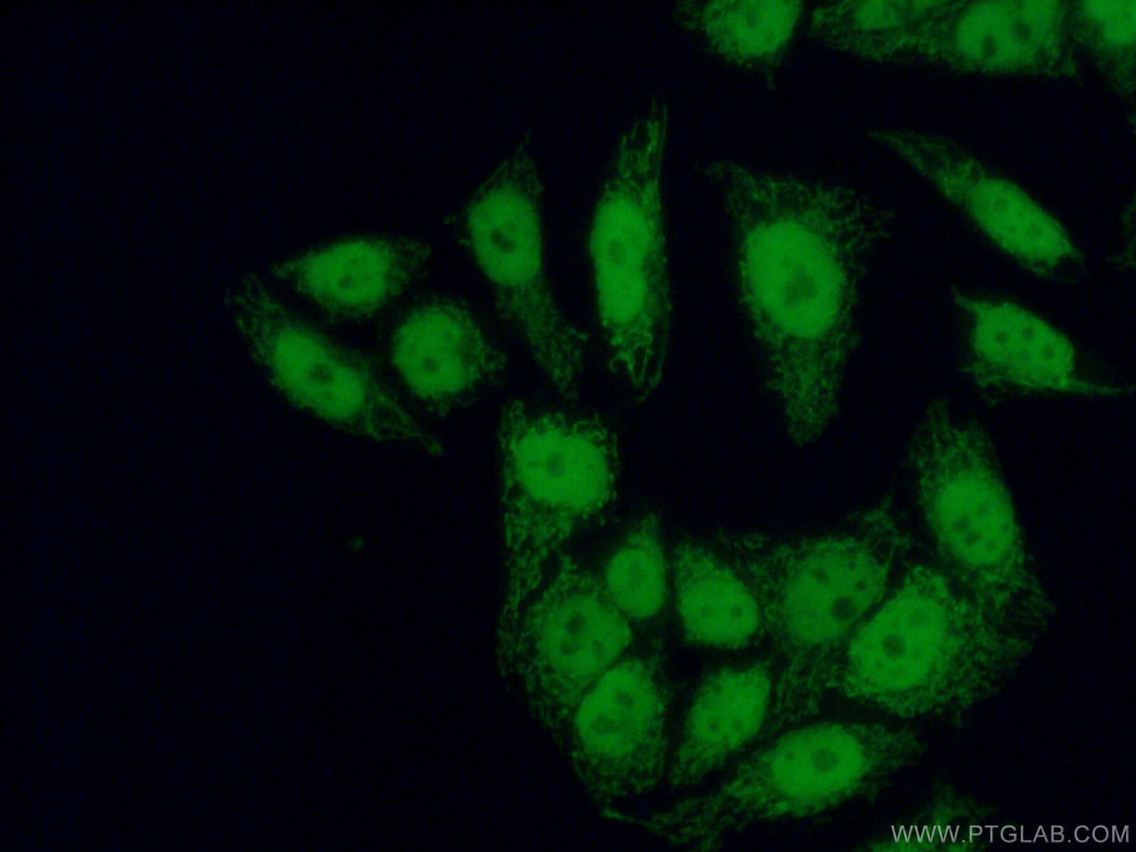 IF Staining of HeLa using 16031-1-AP