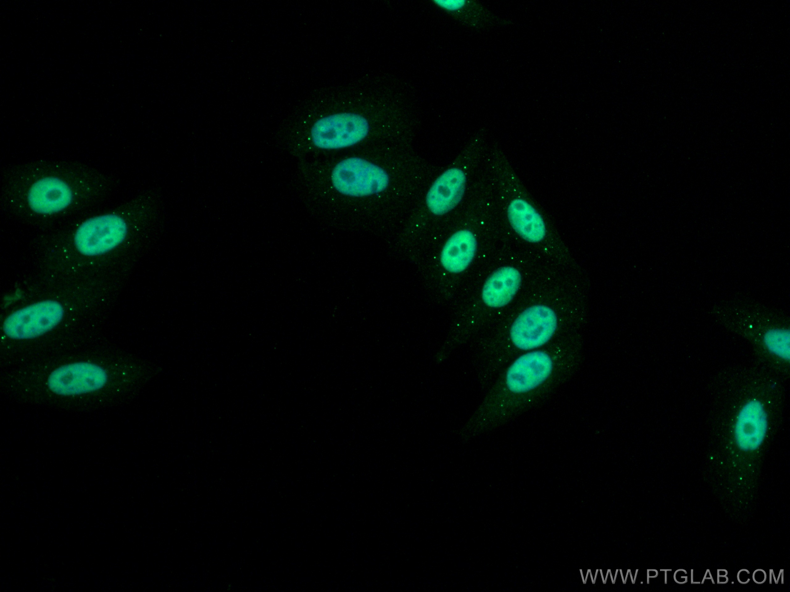 IF Staining of HepG2 using 21625-1-AP