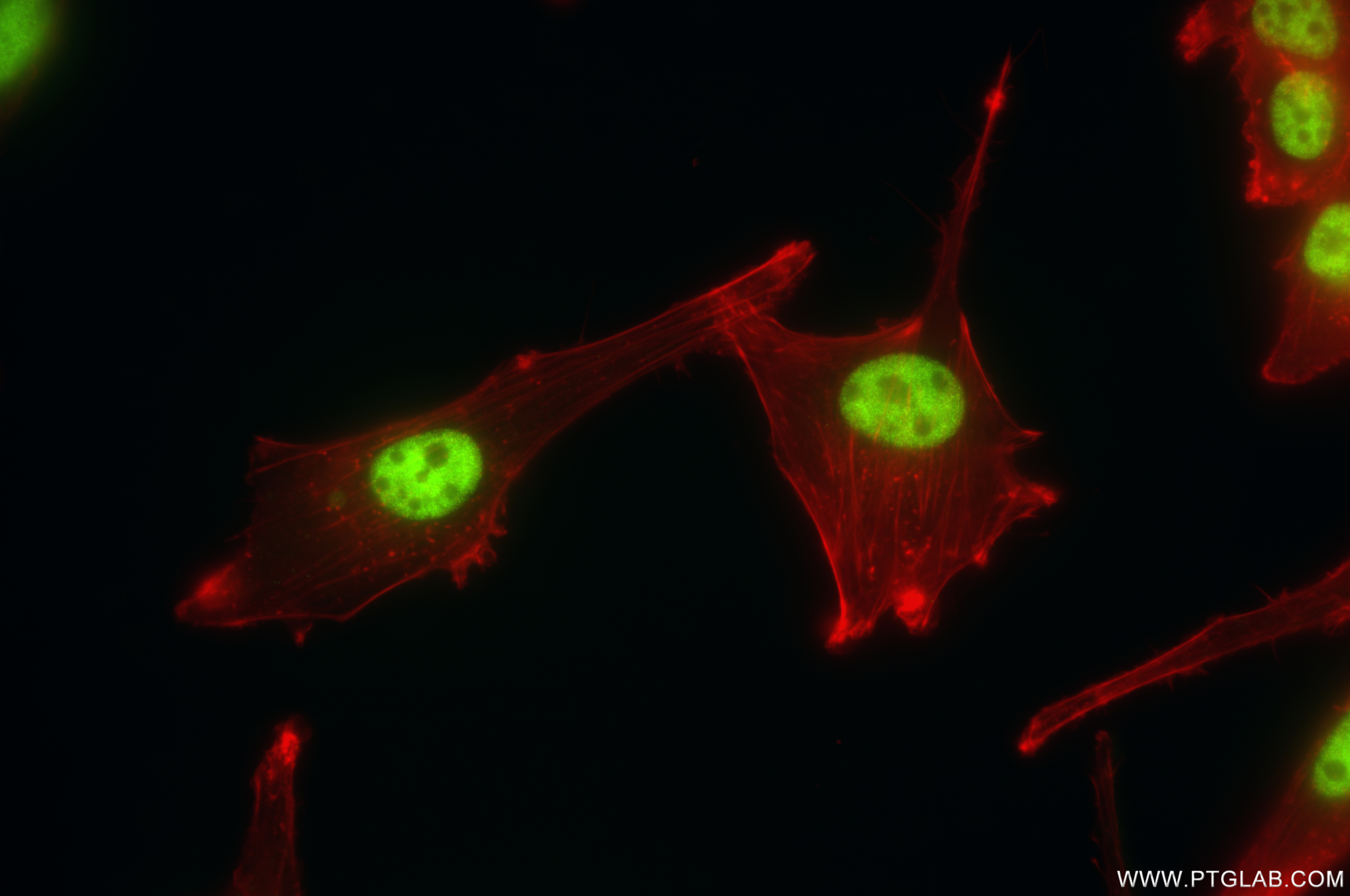 IF Staining of U-87 MG using 85630-6-RR