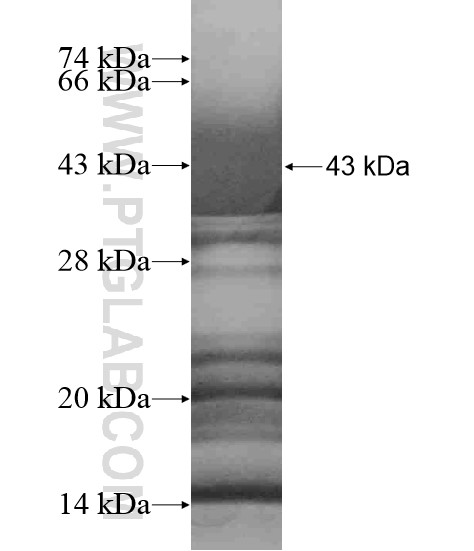 RNF215 fusion protein Ag18750 SDS-PAGE RNF215 fusion protein Ag18750 SDS-PAGE