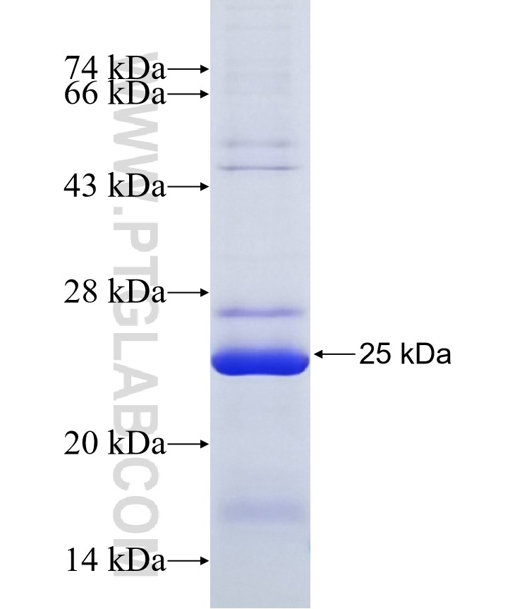 RNF215 fusion protein Ag18891 SDS-PAGE RNF215 fusion protein Ag18891 SDS-PAGE