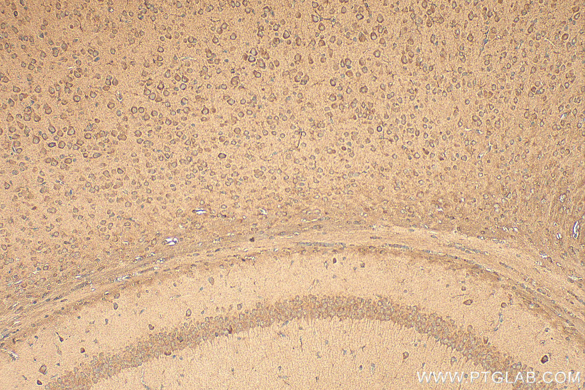 Immunohistochemical analysis of paraffin-embedded mouse brain tissue slide using 10185-1-AP (RNF216 antibody) at dilution of 1:200 (under 10x lens). Heat mediated antigen retrieval with Tris-EDTA buffer (pH 9.0). IHC staining of mouse brain using 10185-1-AP