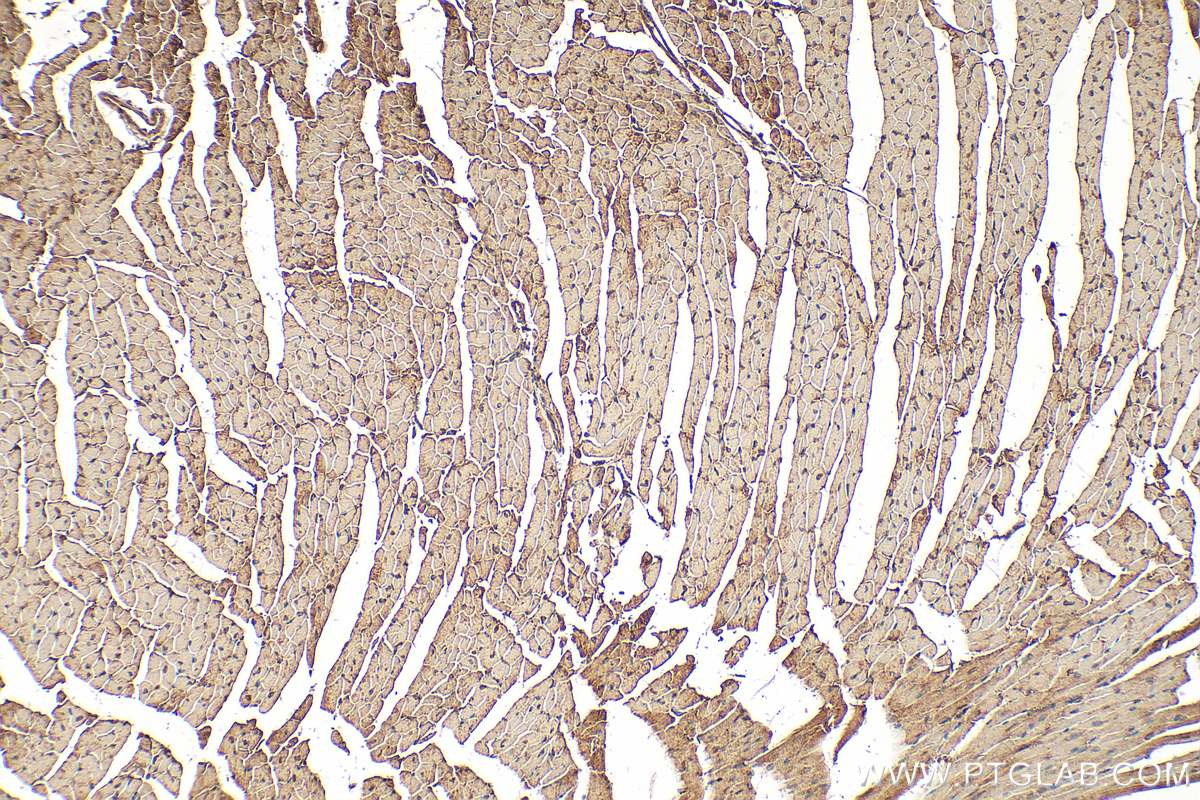 Immunohistochemical analysis of paraffin-embedded mouse heart tissue slide using 10185-1-AP (RNF216 antibody) at dilution of 1:200 (under 10x lens). Heat mediated antigen retrieval with Tris-EDTA buffer (pH 9.0). IHC staining of mouse heart using 10185-1-AP