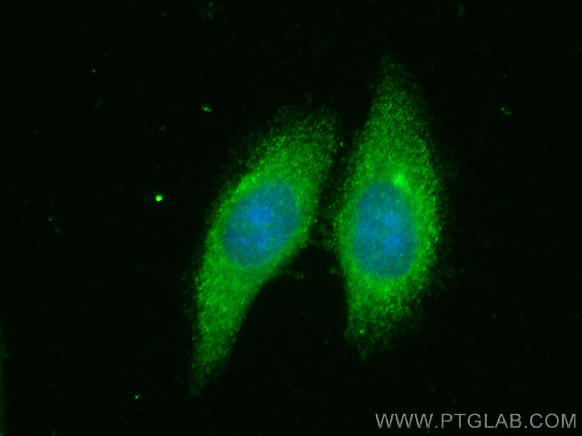 IF Staining of HepG2 using 26084-1-AP