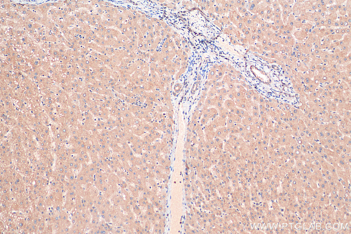 IHC staining of human liver using 26084-1-AP