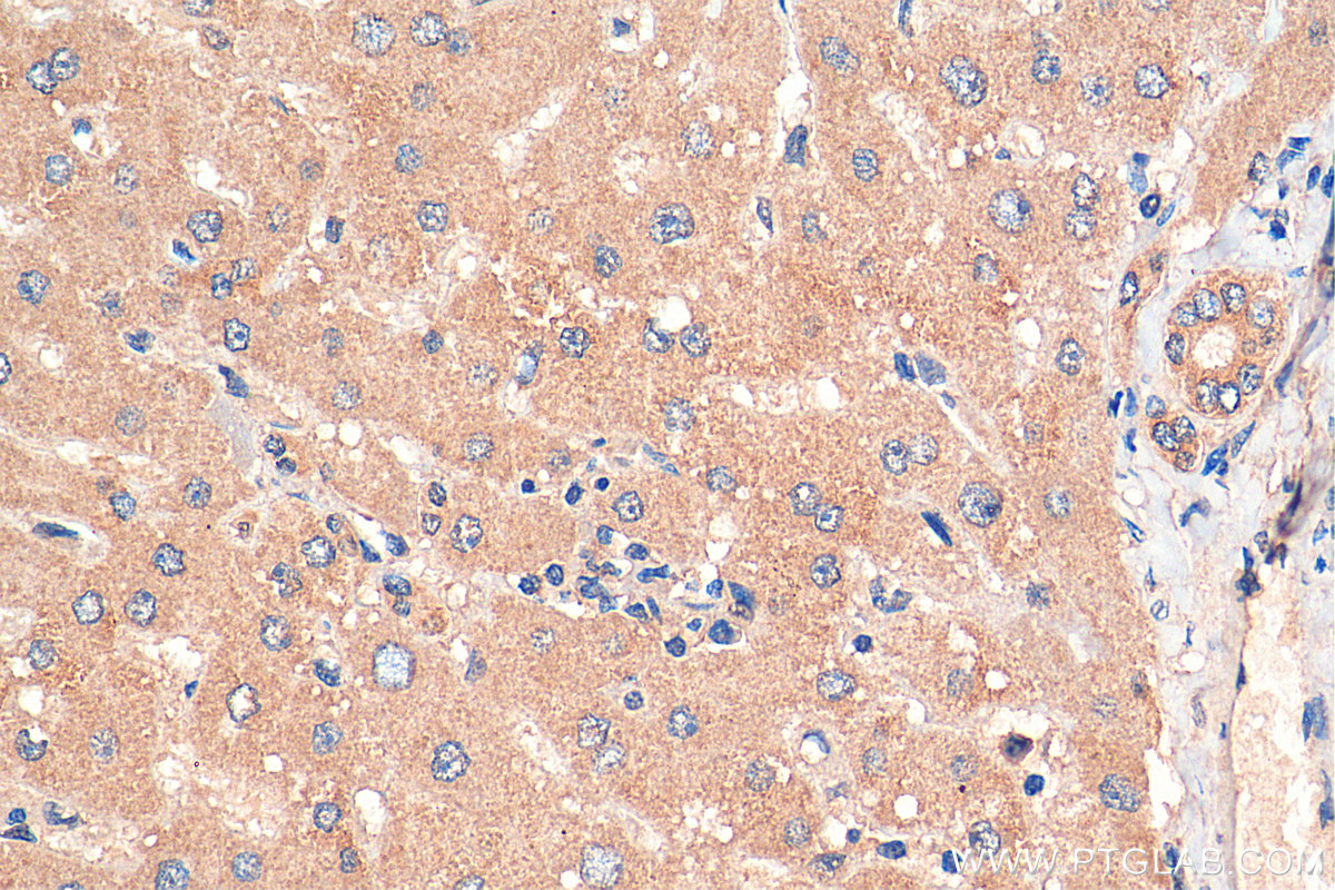 IHC staining of human liver using 26084-1-AP