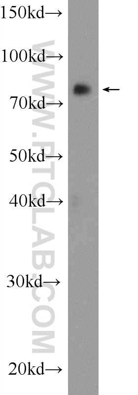 WB analysis of HEK-293T using 24988-1-AP