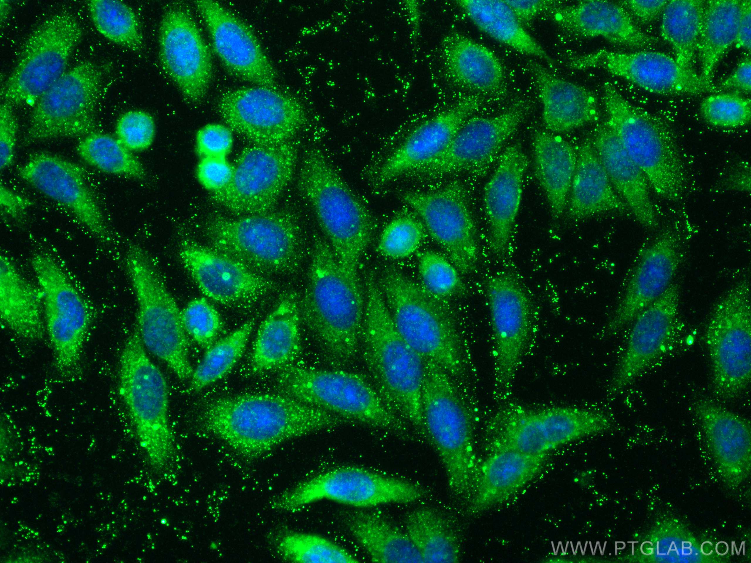 IF Staining of HepG2 using 30797-1-AP