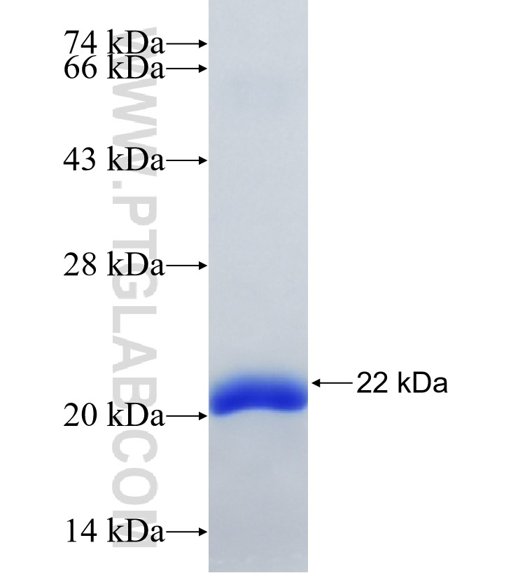 RNF31 fusion protein Ag34426 SDS-PAGE RNF31 fusion protein Ag34426 SDS-PAGE