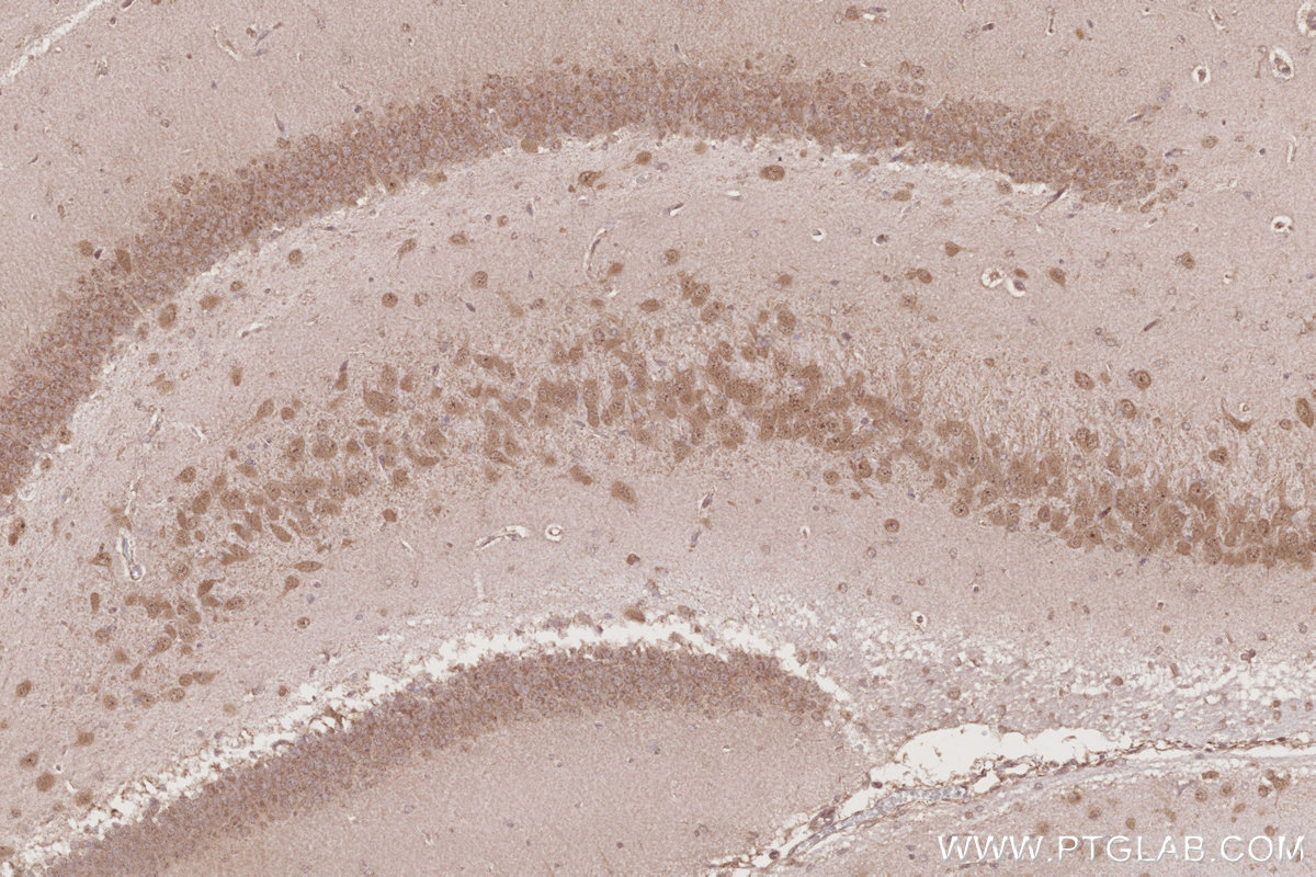 IHC staining of rat brain using 10629-1-AP
