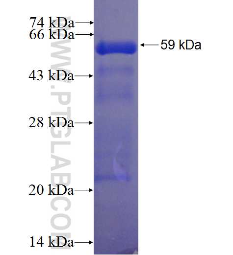 RNF34 fusion protein Ag0982 SDS-PAGE