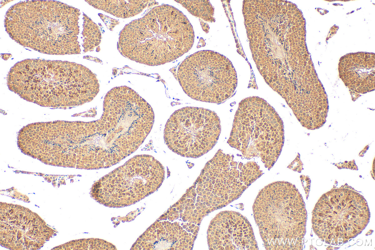 Immunohistochemical analysis of paraffin-embedded mouse testis tissue slide using 17810-1-AP (RNF4 antibody) at dilution of 1:2000 (under 10x lens). Heat mediated antigen retrieval with Tris-EDTA buffer (pH 9.0). IHC staining of mouse testis using 17810-1-AP