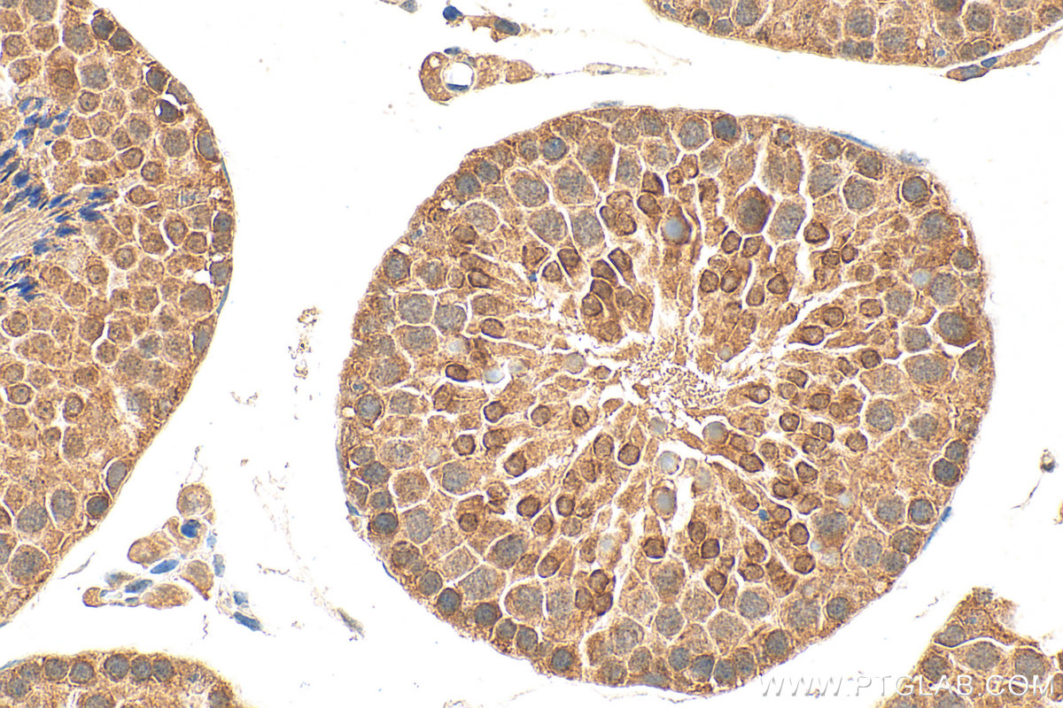 Immunohistochemical analysis of paraffin-embedded mouse testis tissue slide using 17810-1-AP (RNF4 antibody) at dilution of 1:2000 (under 40x lens). Heat mediated antigen retrieval with Tris-EDTA buffer (pH 9.0). IHC staining of mouse testis using 17810-1-AP