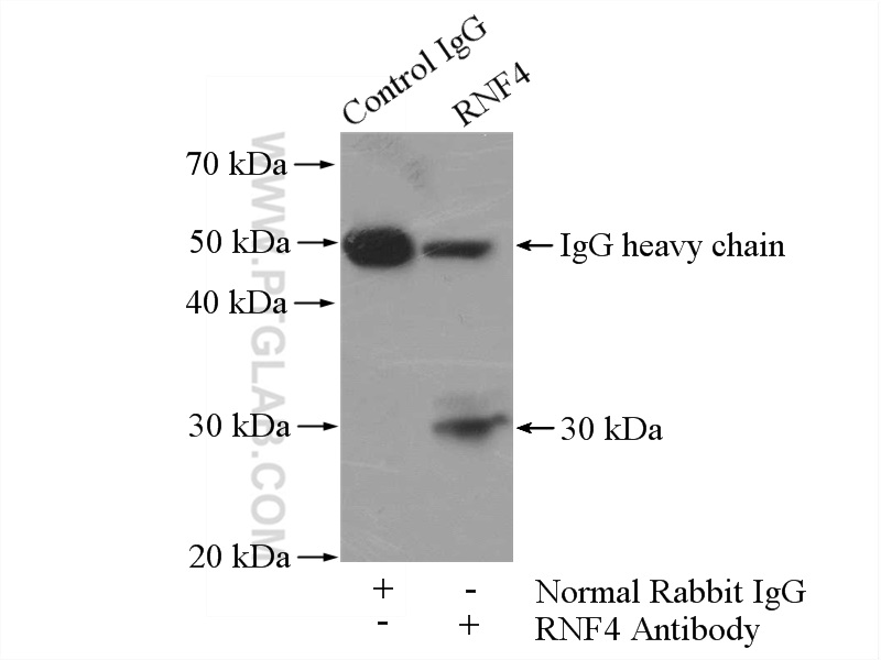 IP experiment of PC-3 using 17810-1-AP