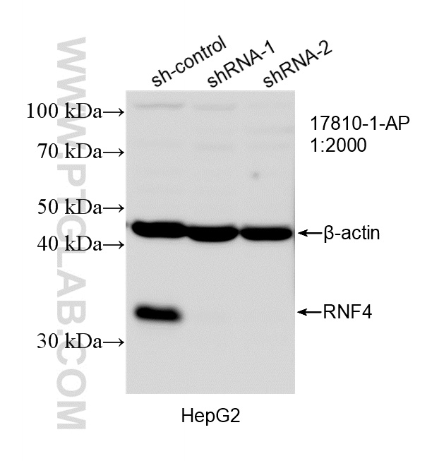 WB result of RNF4 antibody (17810-1-AP; 1:2000; incubated at room temperature for 1.5 hours) with sh-Control and sh-RNF4 transfected HepG2 cells. WB analysis of HepG2 using 17810-1-AP