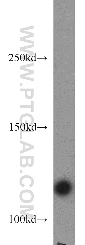 WB analysis of mouse liver using 15621-1-AP