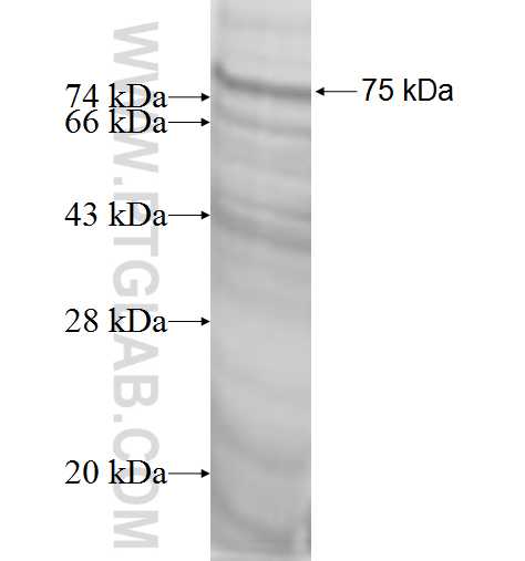 RNF40 fusion protein Ag0953 SDS-PAGE RNF40 fusion protein Ag0953 SDS-PAGE