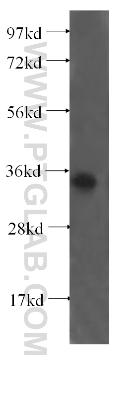 WB analysis of human testis using 17233-1-AP