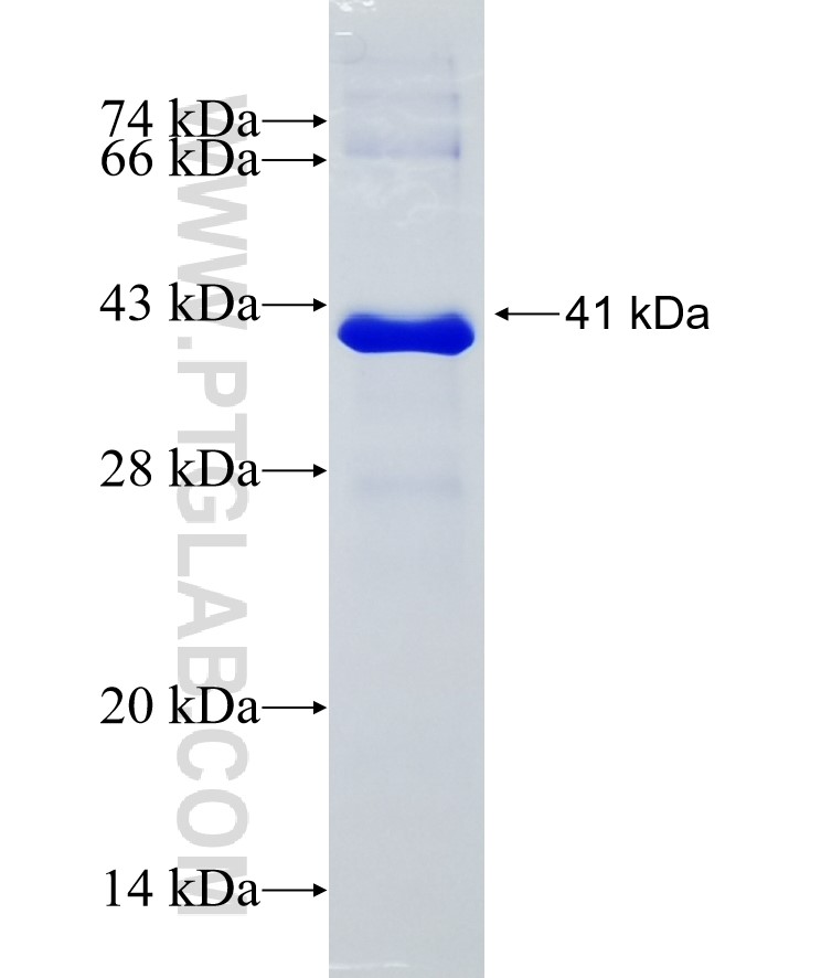 RNF41 fusion protein Ag11123 SDS-PAGE