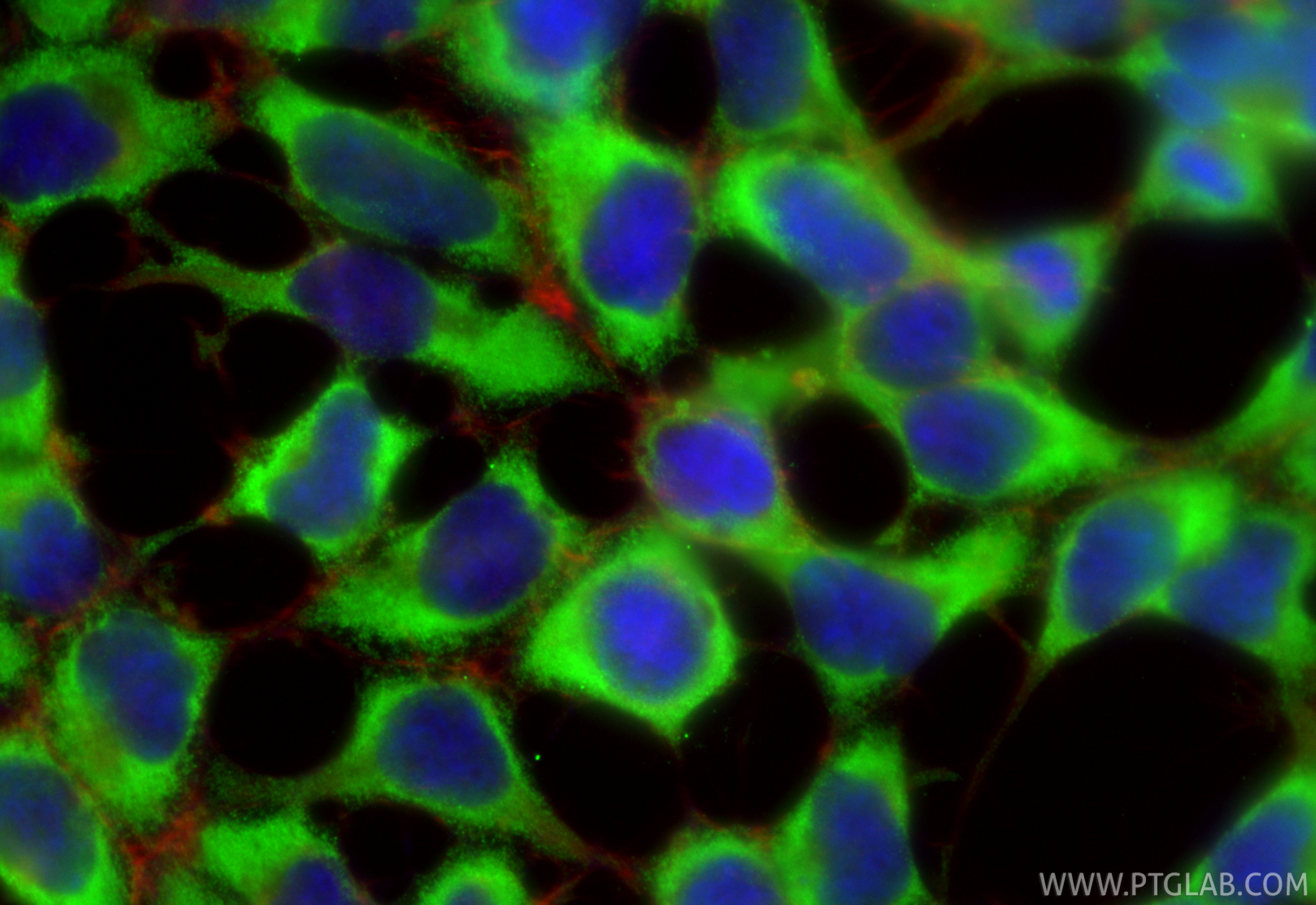 IF Staining of HEK-293 using 86740-1-RR IF Staining of HEK-293 using 86740-1-RR