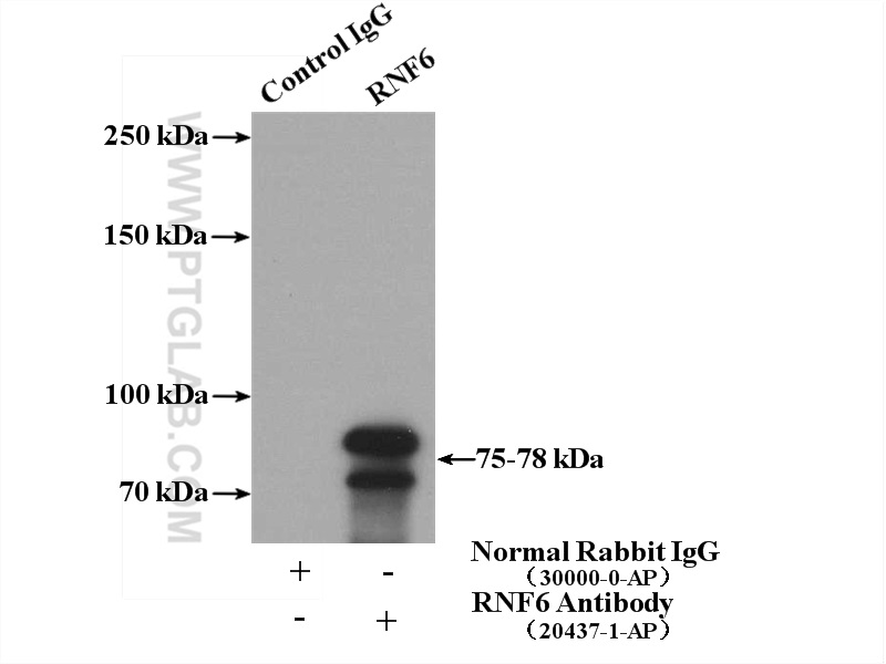 IP experiment of mouse testis using 20437-1-AP