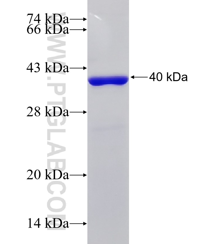 RNF6 fusion protein Ag14899 SDS-PAGE RNF6 fusion protein Ag14899 SDS-PAGE