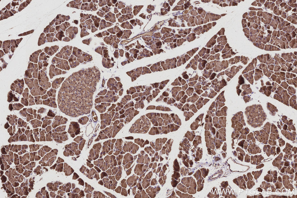 IHC staining of mouse pancreas using 11905-1-AP IHC staining of mouse pancreas using 11905-1-AP