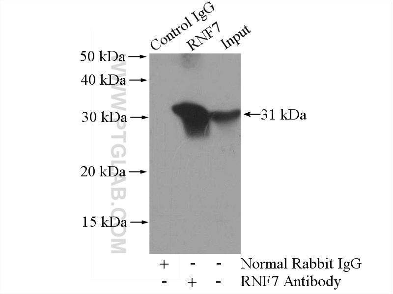 IP experiment of mouse heart using 11905-1-AP