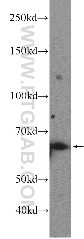 WB analysis of HeLa using 14112-1-AP