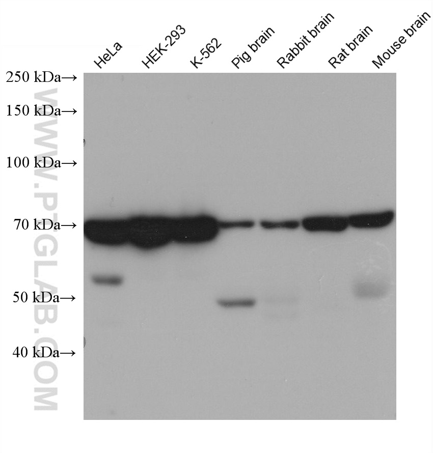 WB analysis using 68521-1-Ig