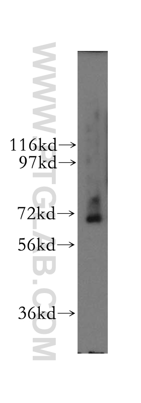 WB analysis of human kidney using 12430-1-AP