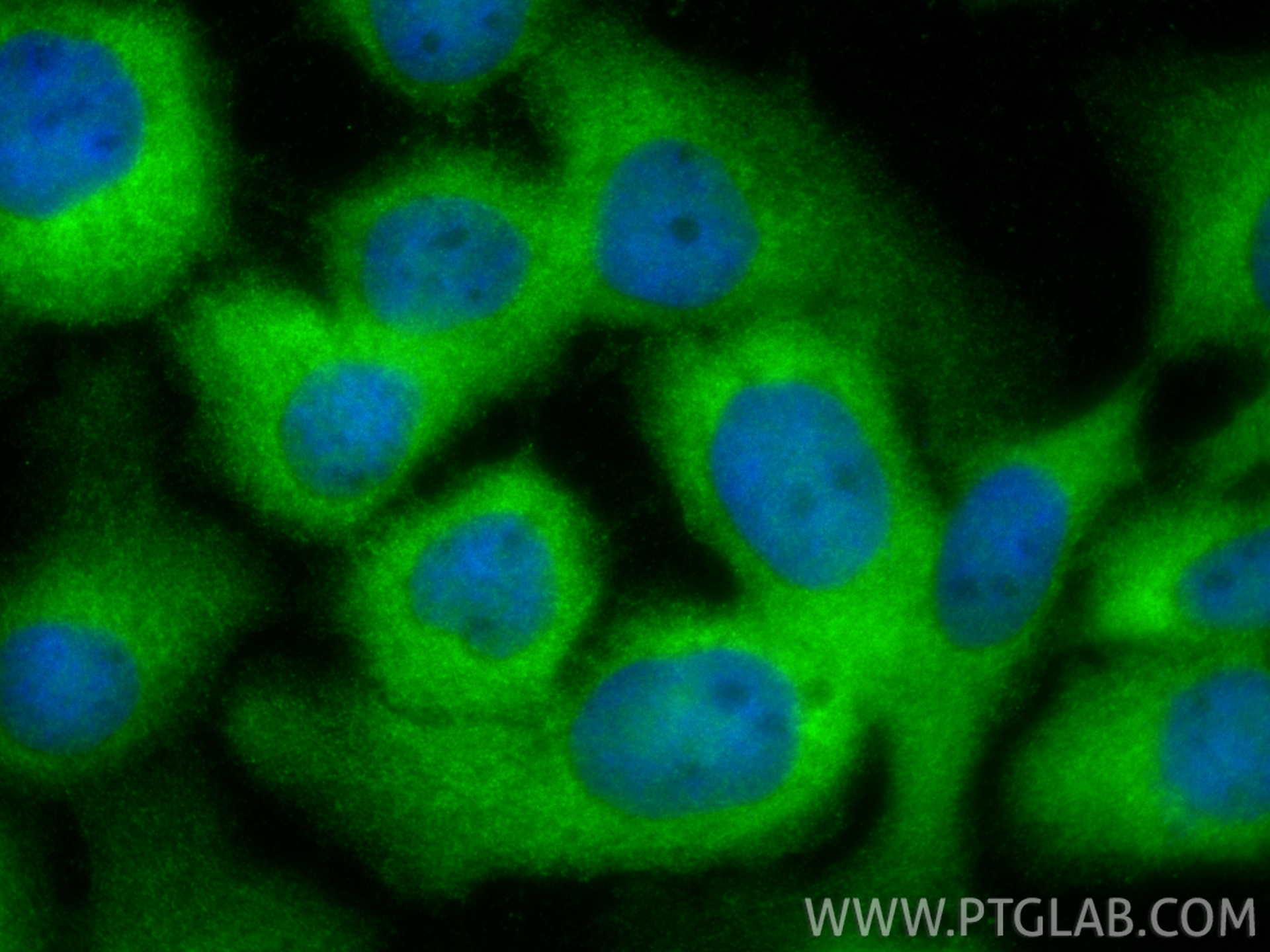 Immunofluorescent analysis of (-20°C Methanol) fixed A431 cells using RNH1 antibody (10345-1-AP) at dilution of 1:200 and CoraLite®488-Conjugated Goat Anti-Rabbit IgG(H+L) (<a class='green' href='/productredirect?CatalogNo=SA00013-2' target='_blank'>SA00013-2</a>). IF Staining of A431 using 10345-1-AP