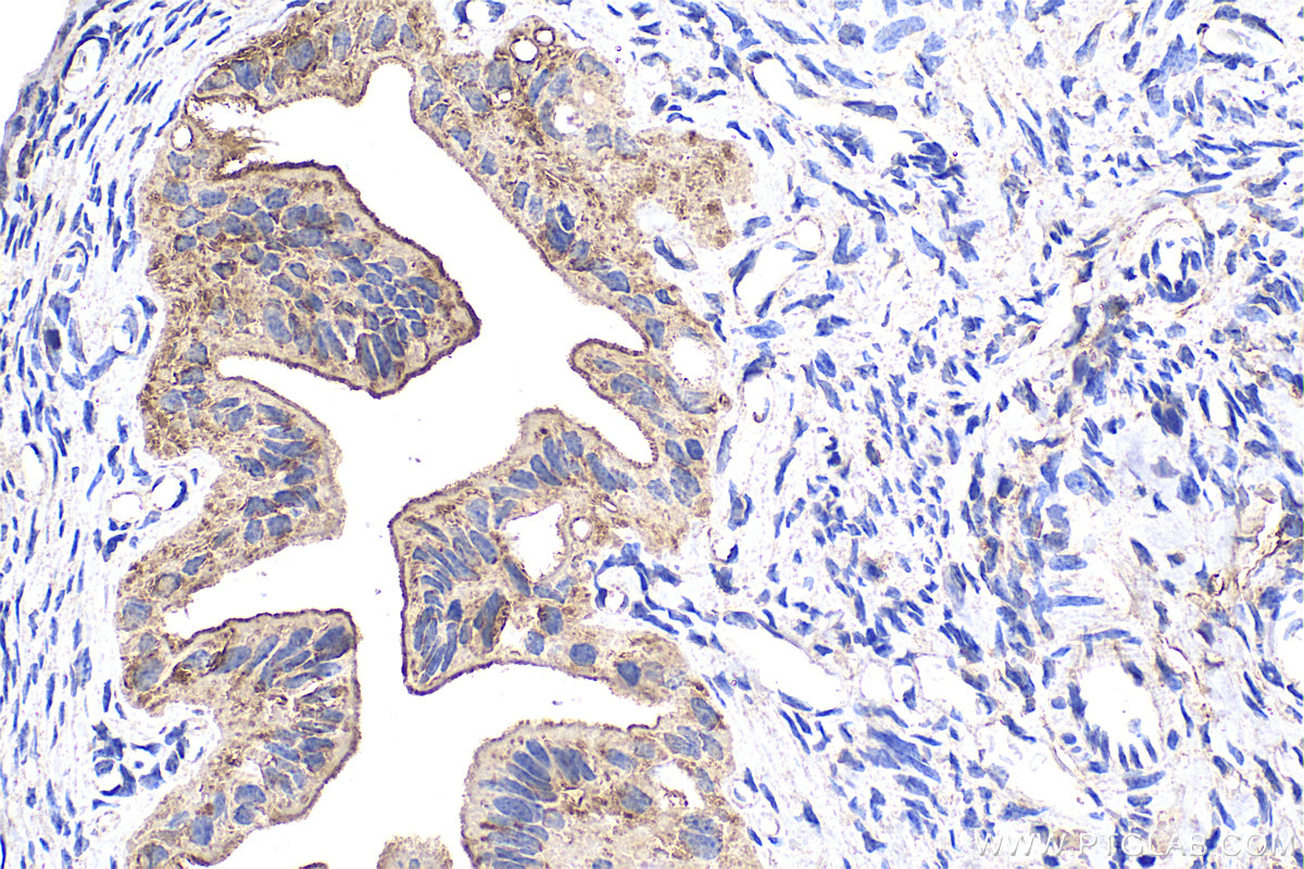 Immunohistochemical analysis of paraffin-embedded mouse ovary tissue slide using 10345-1-AP (RNH1 antibody) at dilution of 1:600 (under 40x lens). Heat mediated antigen retrieval with Tris-EDTA buffer (pH 9.0). IHC staining of mouse ovary using 10345-1-AP