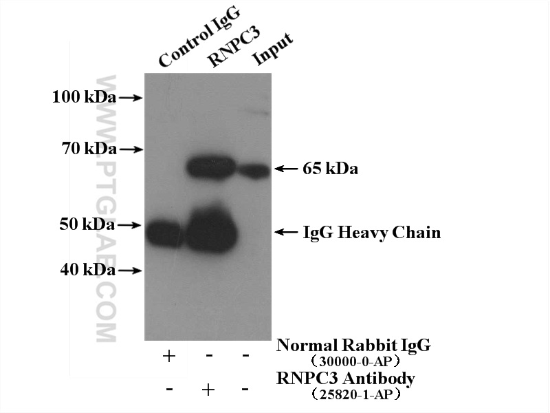 IP experiment of mouse spleen using 25820-1-AP