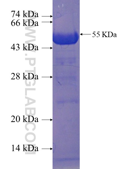 RNPC3 fusion protein Ag22969 SDS-PAGE
