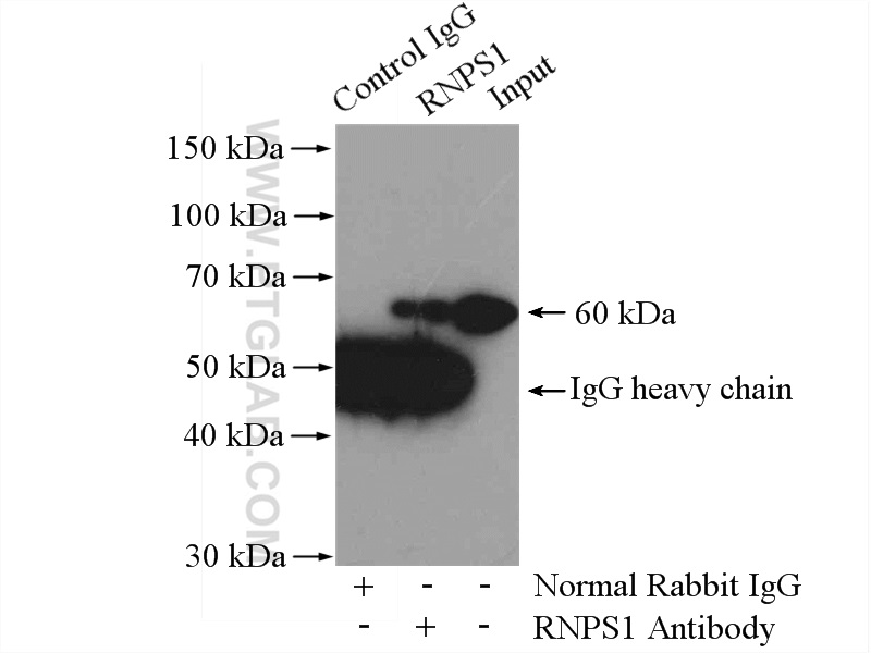 IP experiment of HEK-293 using 10555-1-AP