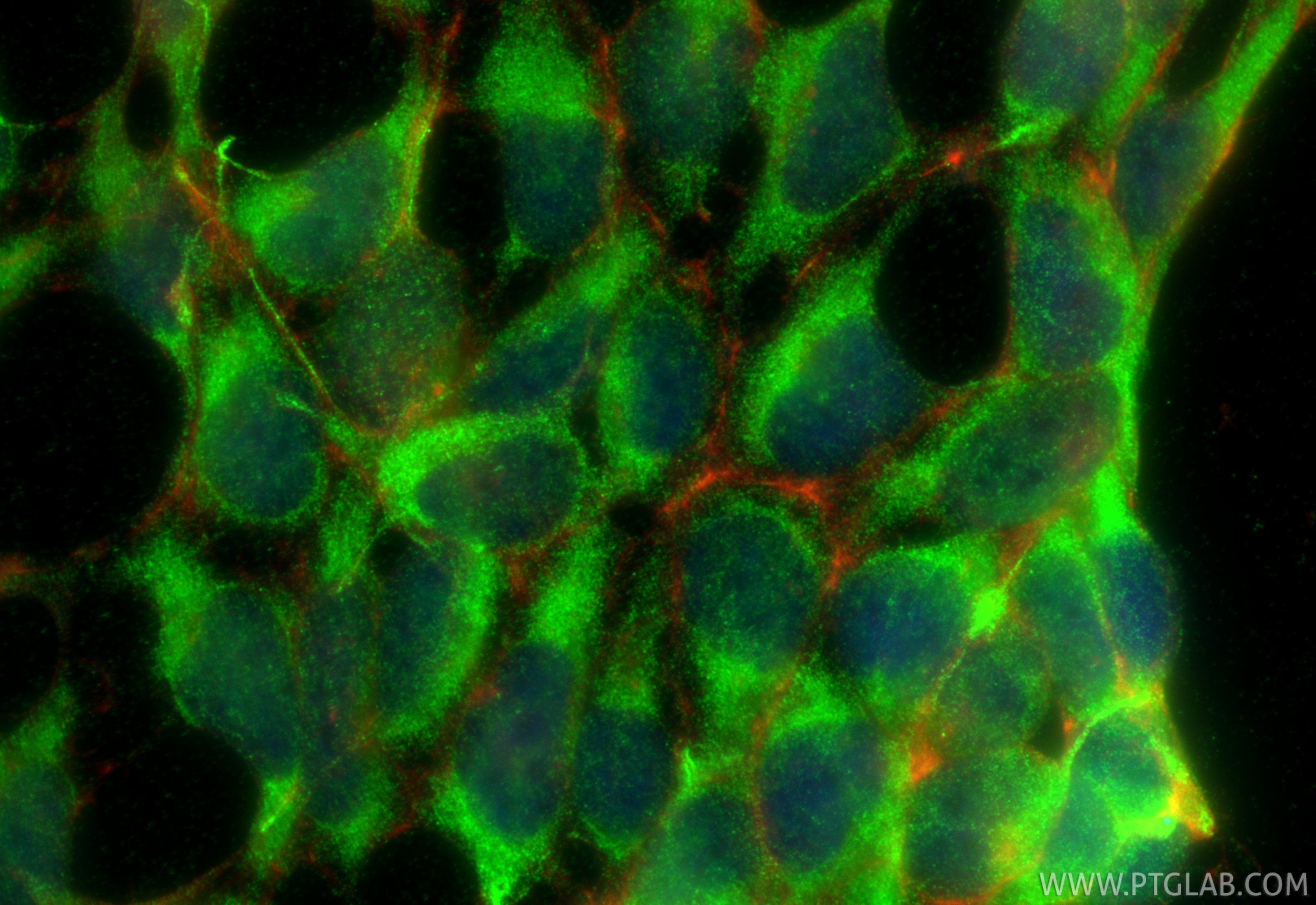IF Staining of HEK-293 using 32844-1-AP