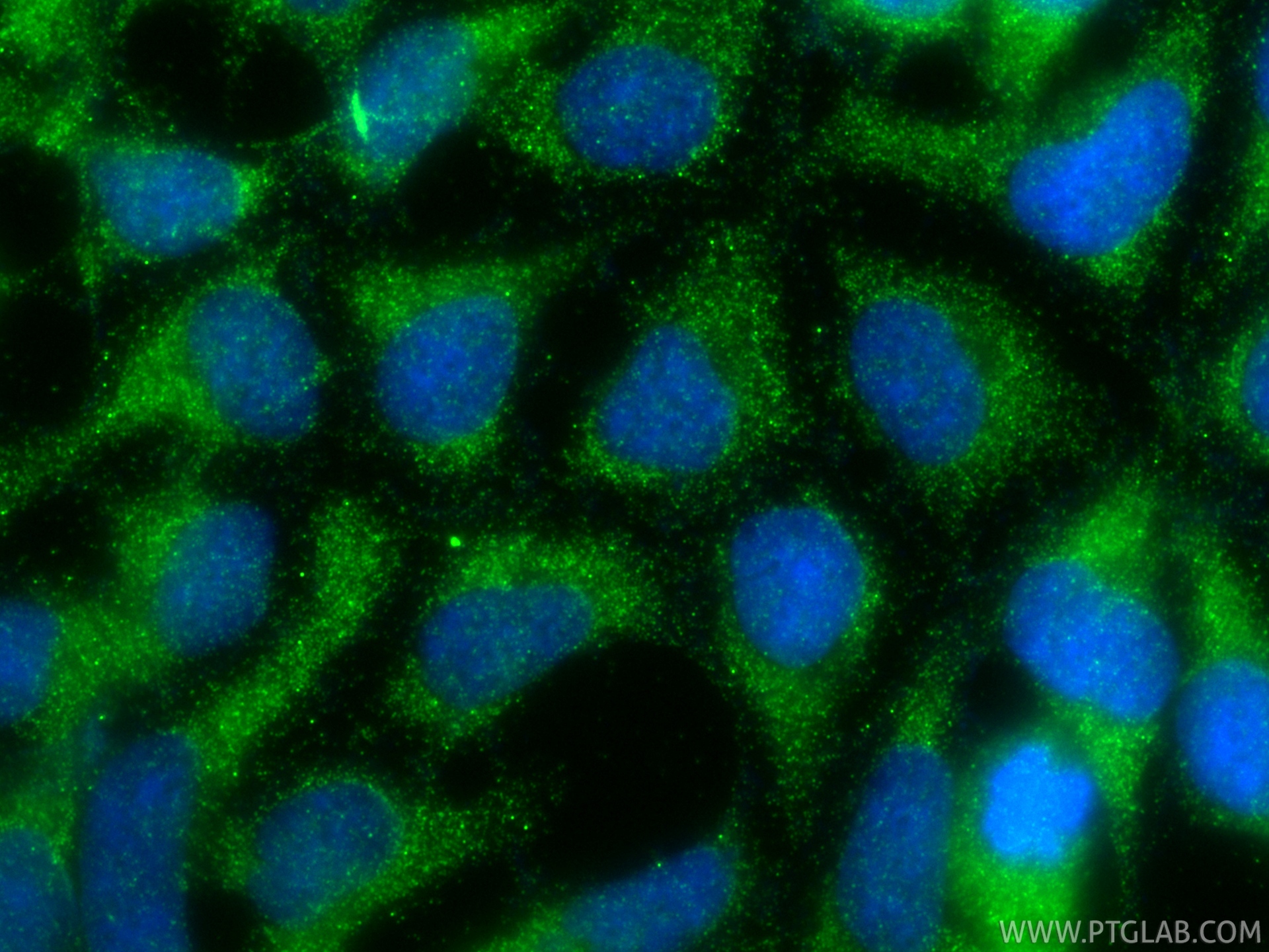 IF Staining of HEK-293 using 32844-1-AP IF Staining of HEK-293 using 32844-1-AP