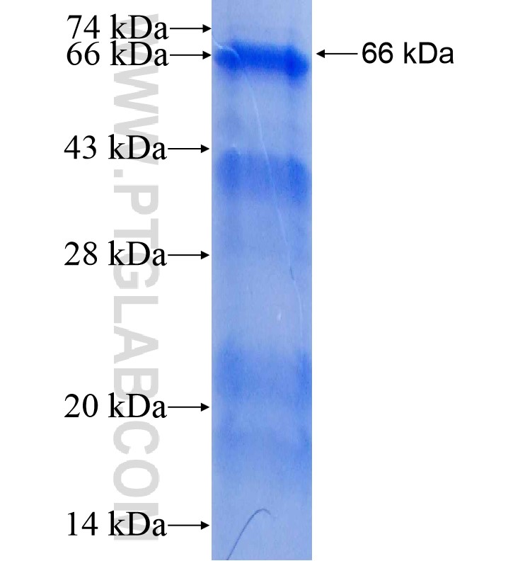 ROBO1 fusion protein Ag16461 SDS-PAGE