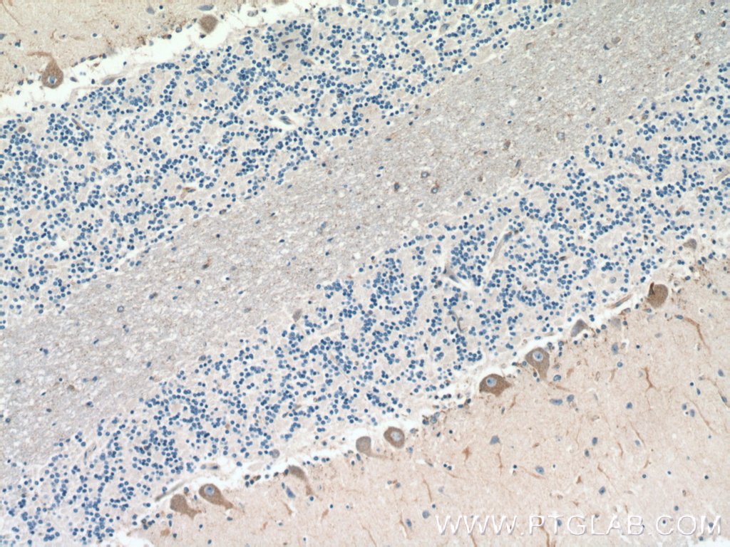 IHC staining of human cerebellum using 19986-1-AP