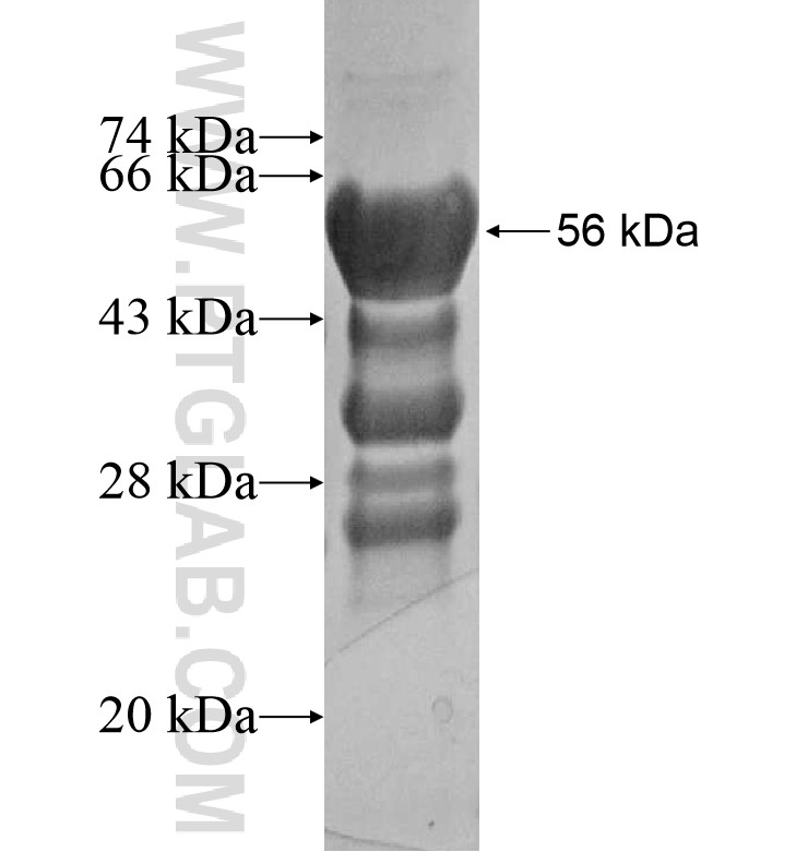 ROBO2 fusion protein Ag16261 SDS-PAGE